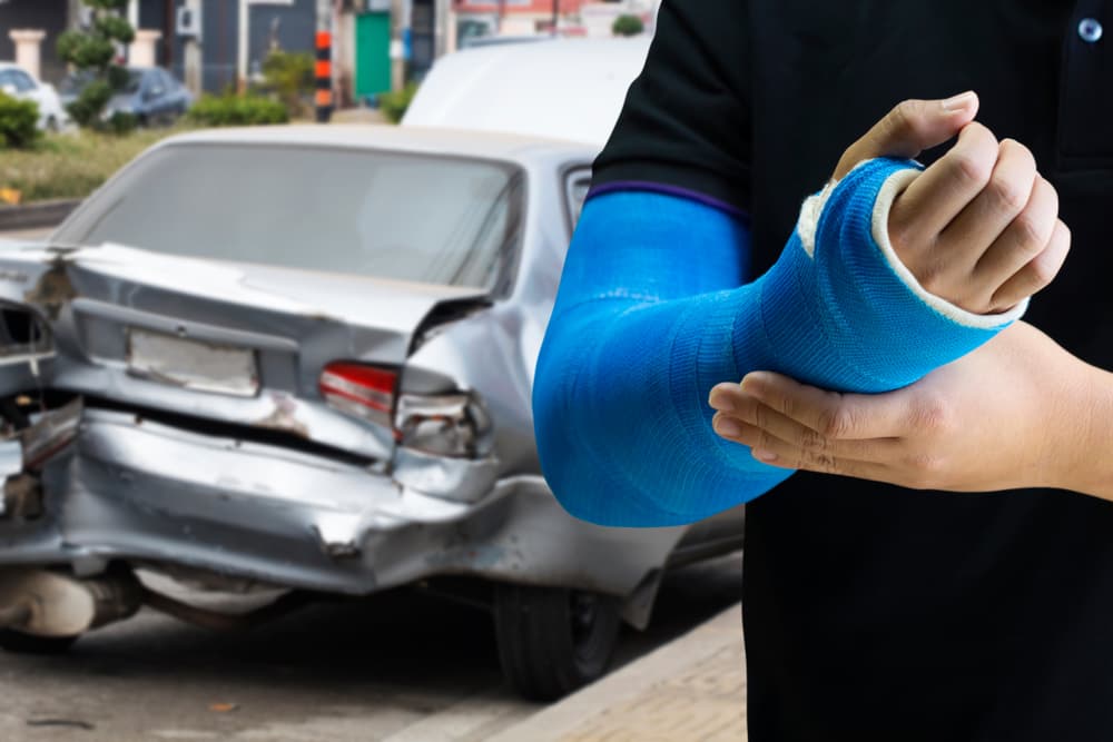 Hand, wrist, and arm injury after a Texas car accident, showing a broken arm in a cast with a damaged vehicle in the background
